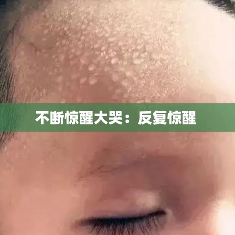 不斷驚醒大哭:反復驚醒
