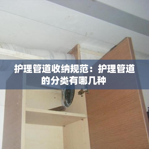 護理管道收納規范:護理管道的分類有哪幾種