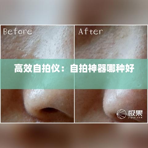 高效自拍儀:自拍神器哪種好