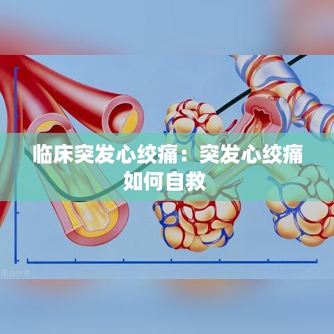 臨床突發(fā)心絞痛:突發(fā)心絞痛如何自救