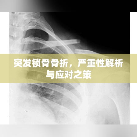 突發(fā)鎖骨骨折,嚴重性解析與應(yīng)對之策