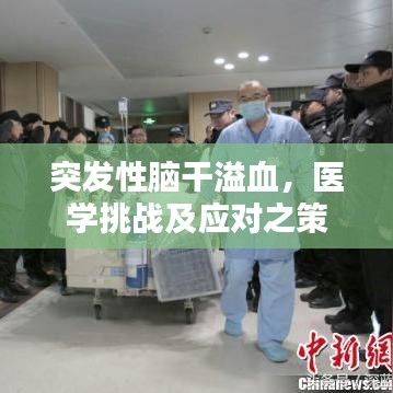 突發性腦干溢血,醫學挑戰及應對之策