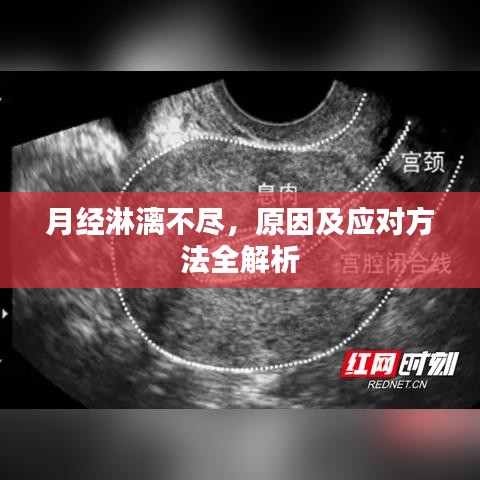 月經(jīng)淋漓不盡,原因及應(yīng)對(duì)方法全解析
