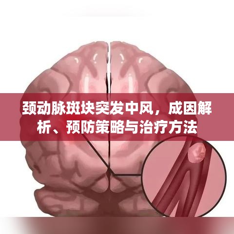 頸動脈斑塊突發中風,成因解析、預防策略與治療方法