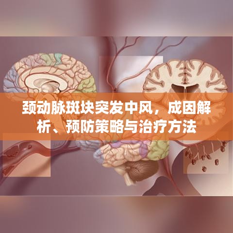 頸動脈斑塊突發中風,成因解析、預防策略與治療方法